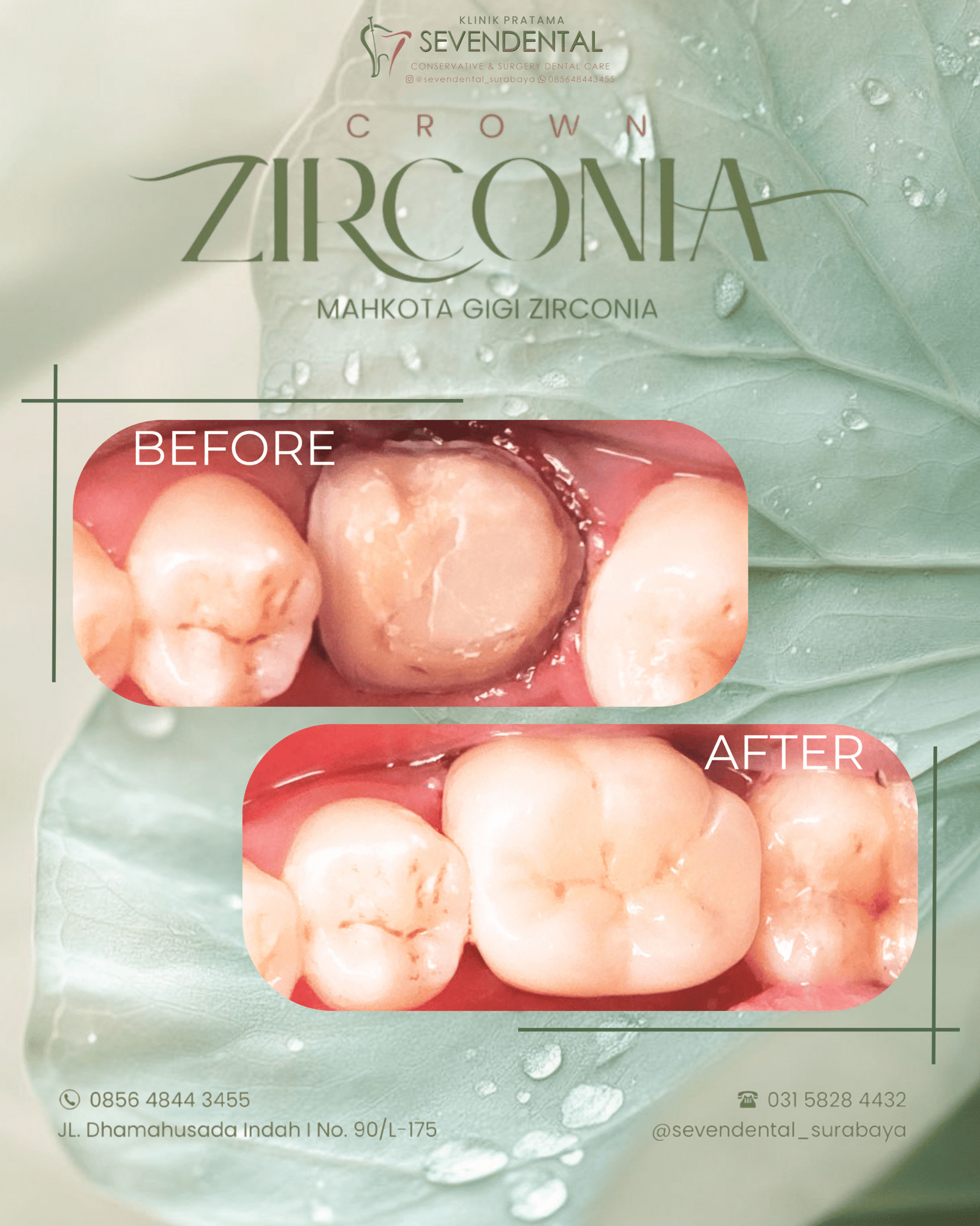 FEED CROWN An. Kresna