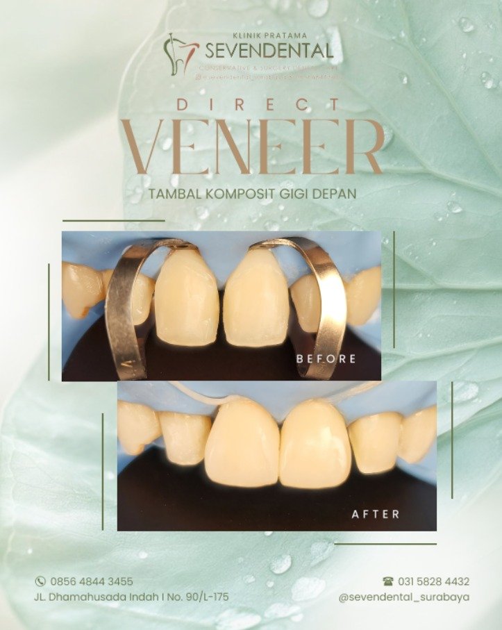 FEED DIRECT VENEER WULANDARI