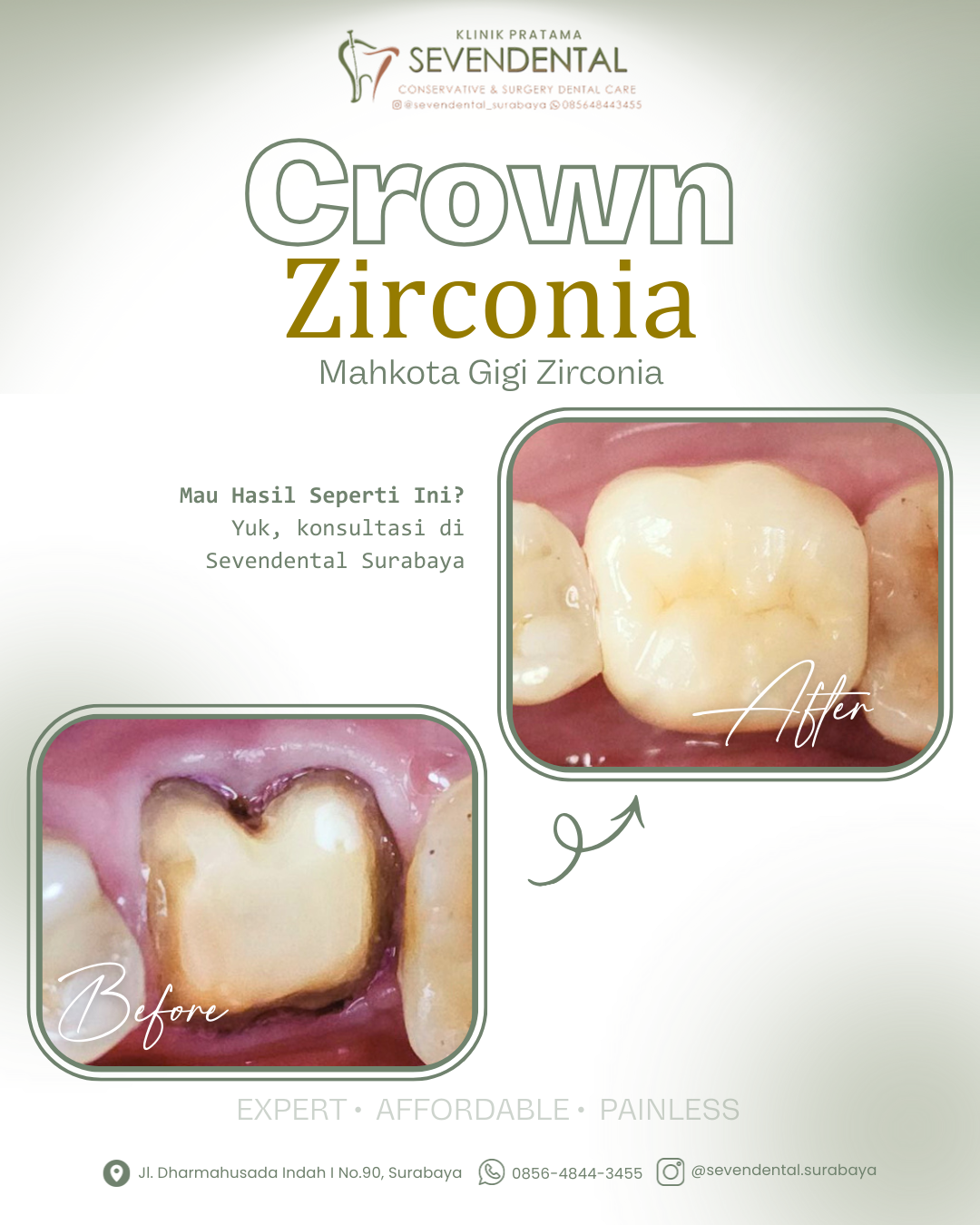 Feed BA crown Tn. iwan Soesanto