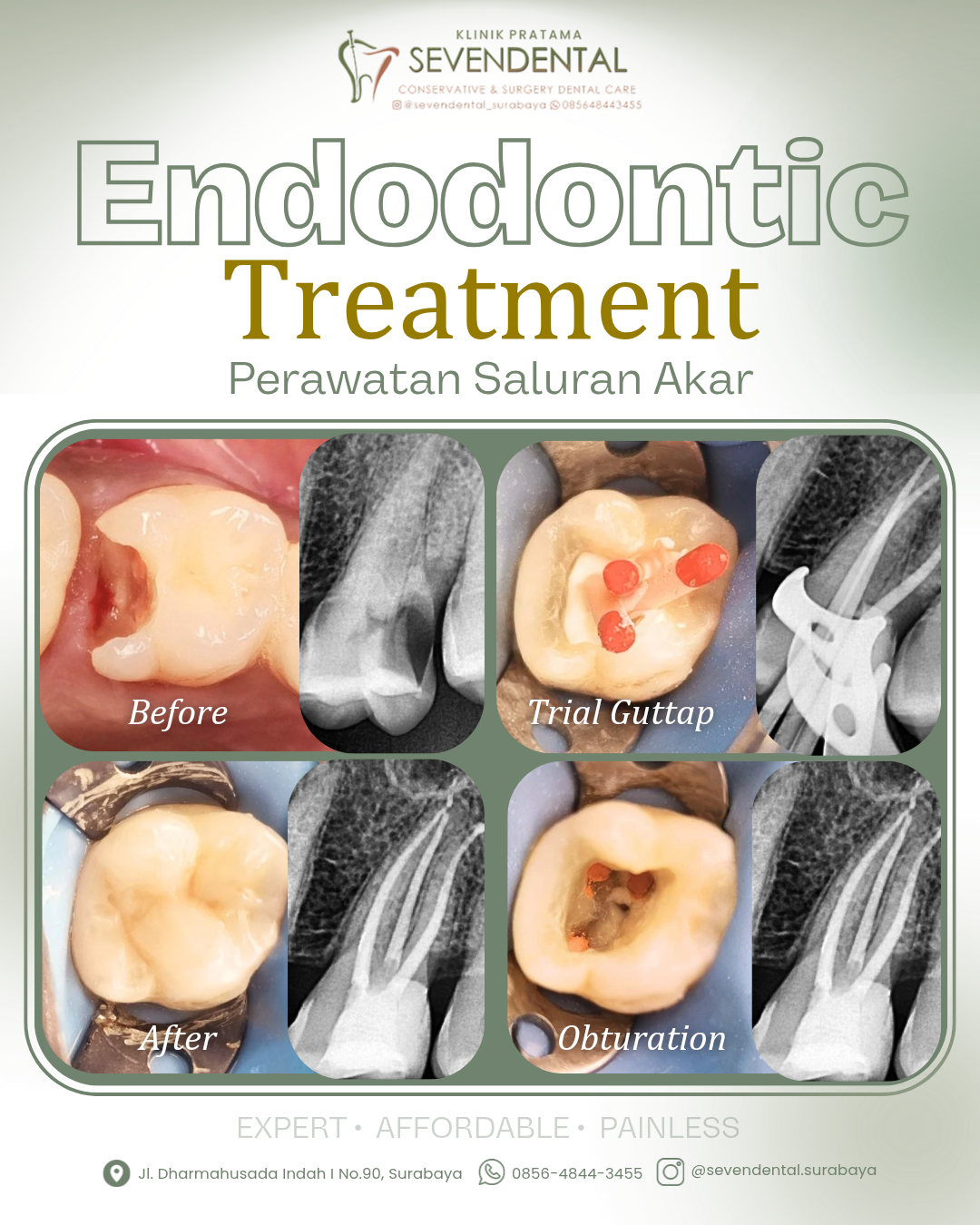 FEED BA ENDODONTIC MIFTAHUL ARIFIN