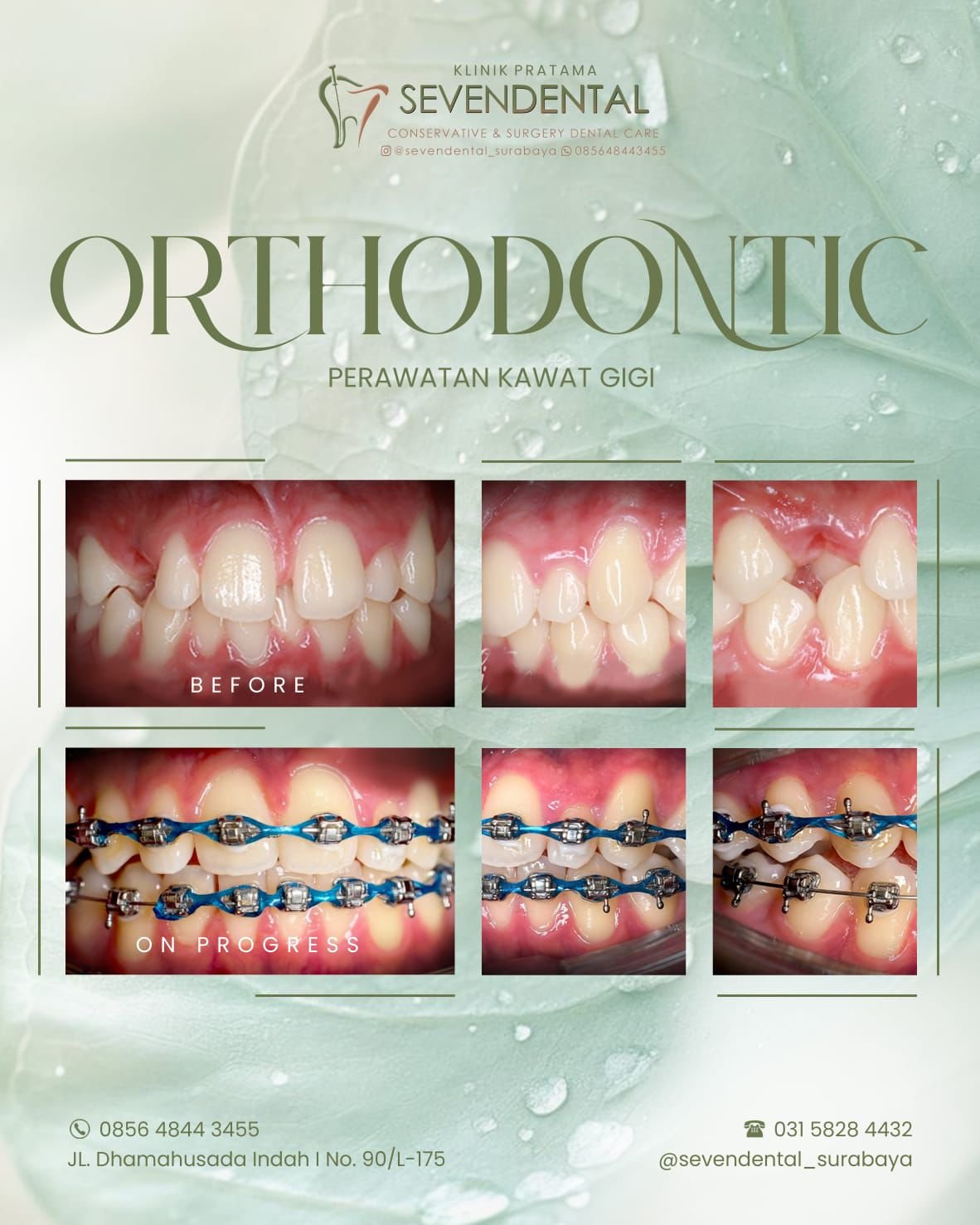 FEED ORTHODONTIC