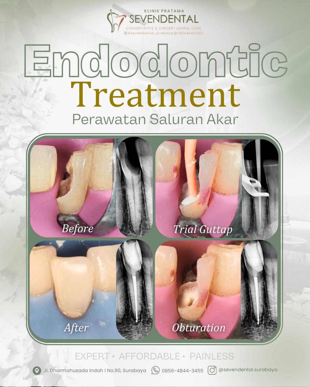 Feed BA Endo Nn. Tabita