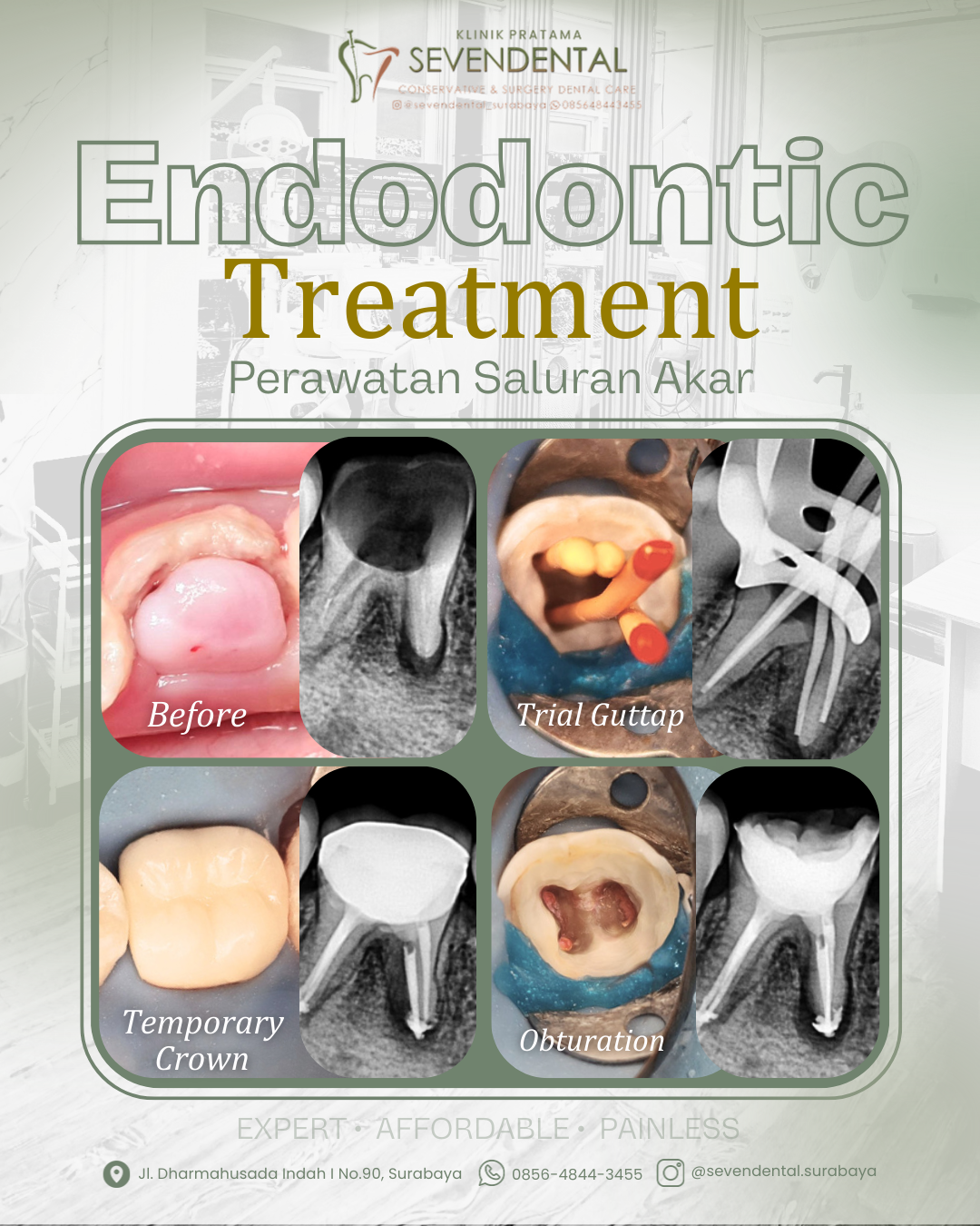 Feed BA Endodontic Nabil Akmal