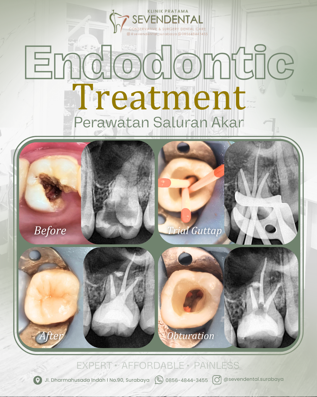Feed BA Endodontic Nn. Syakilla