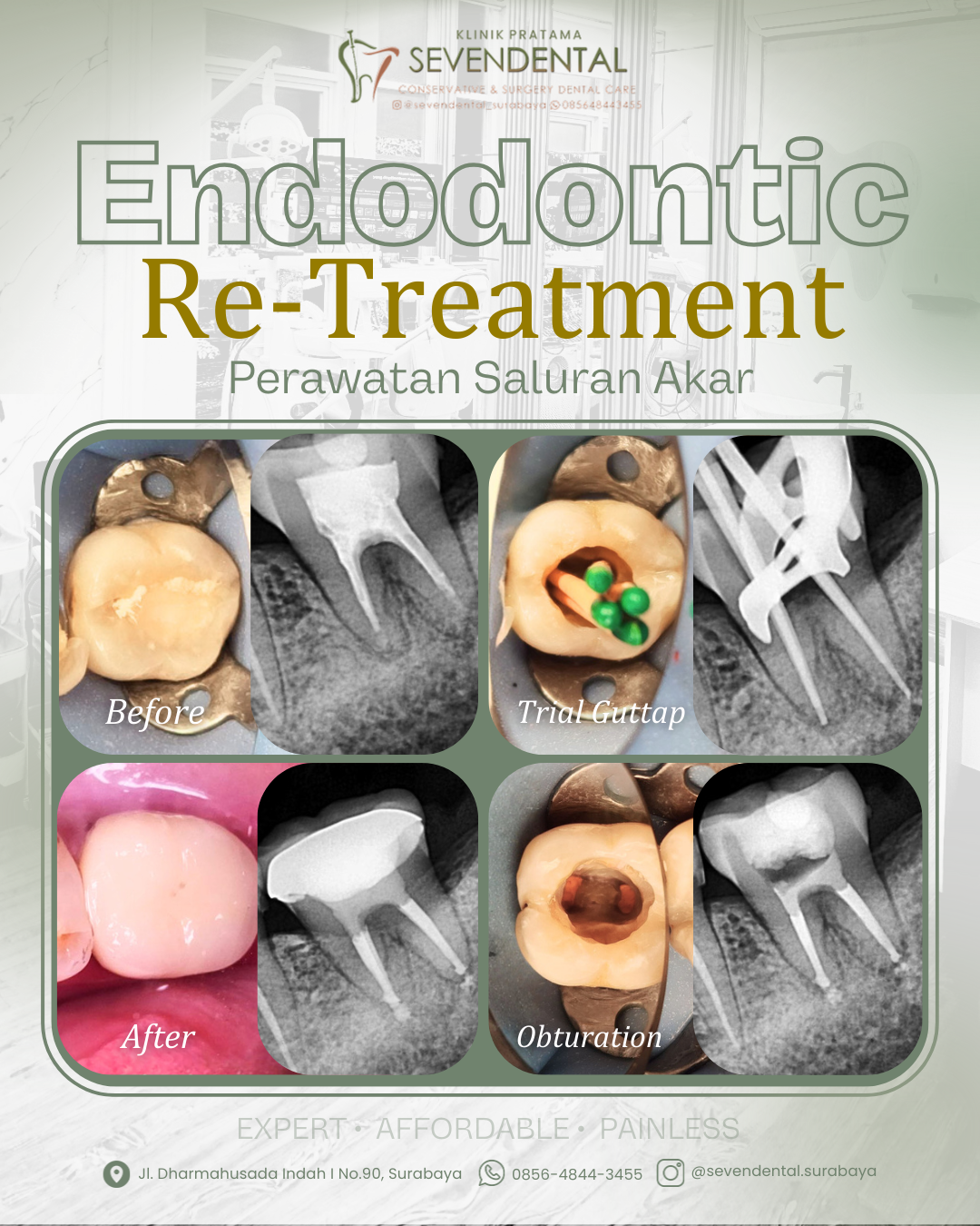 Feed BA Endodontic Ny. Syifa