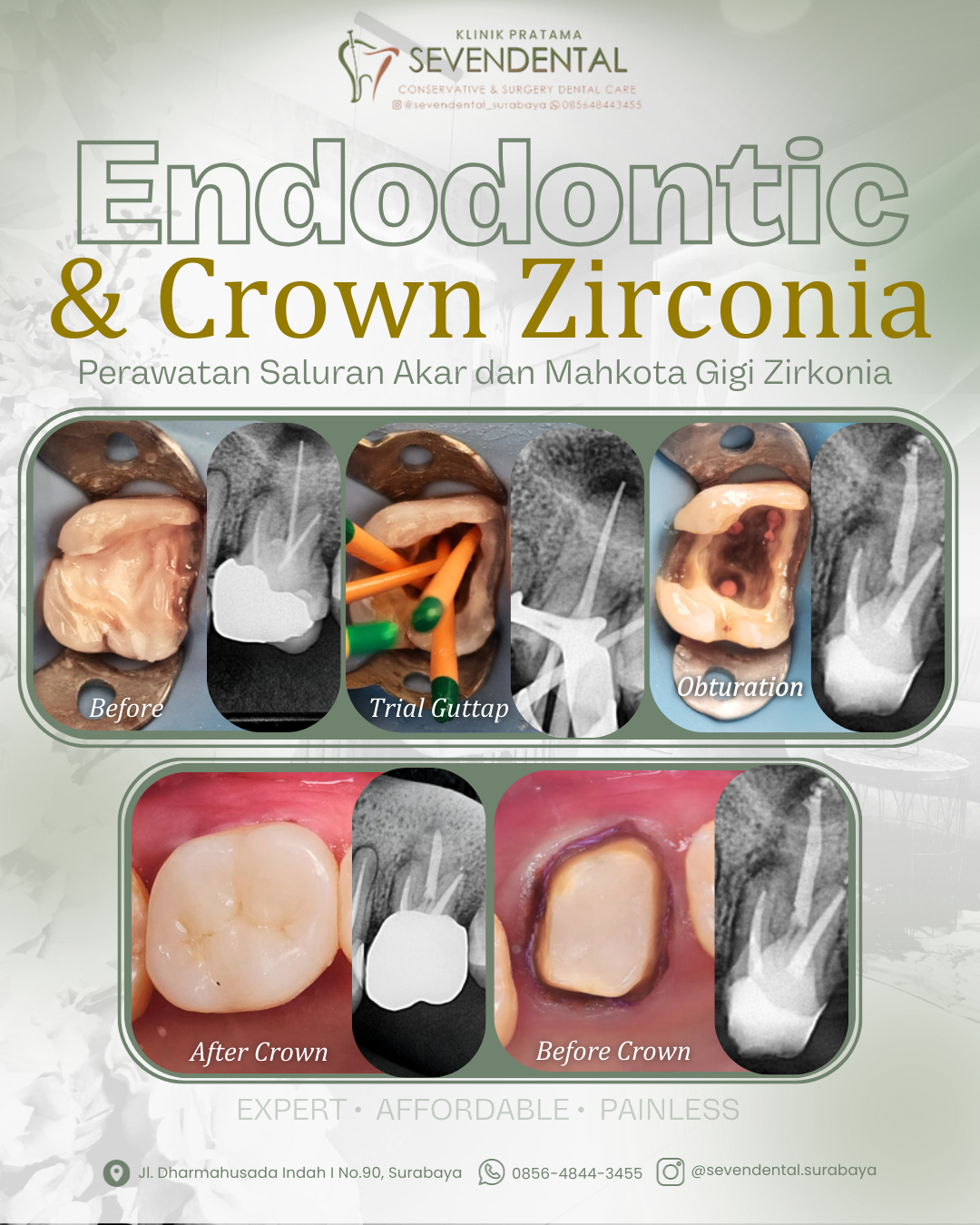 Feed BA PSA dan Crown Ratu