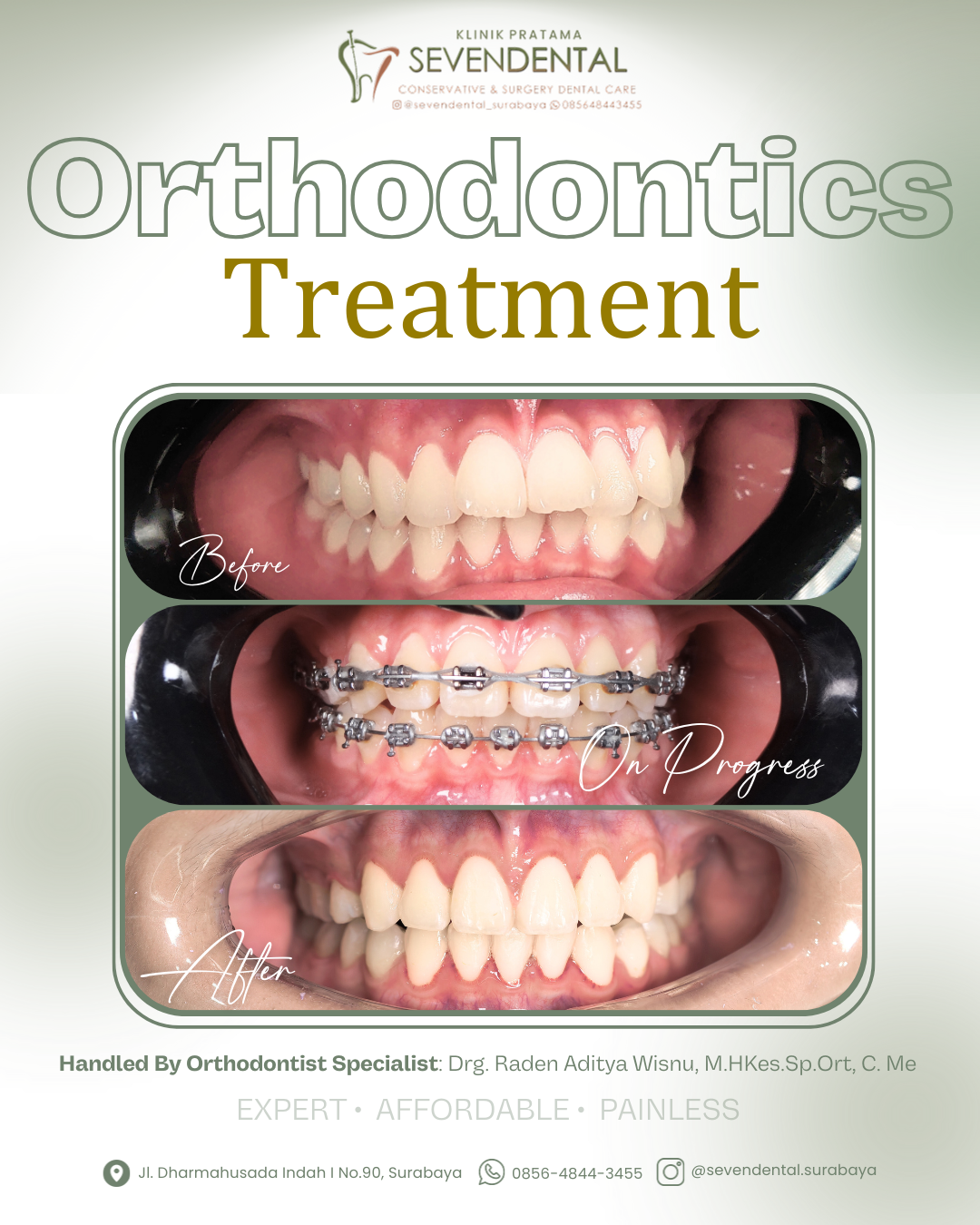 Feed BA ortho Nn. Jasmine lim