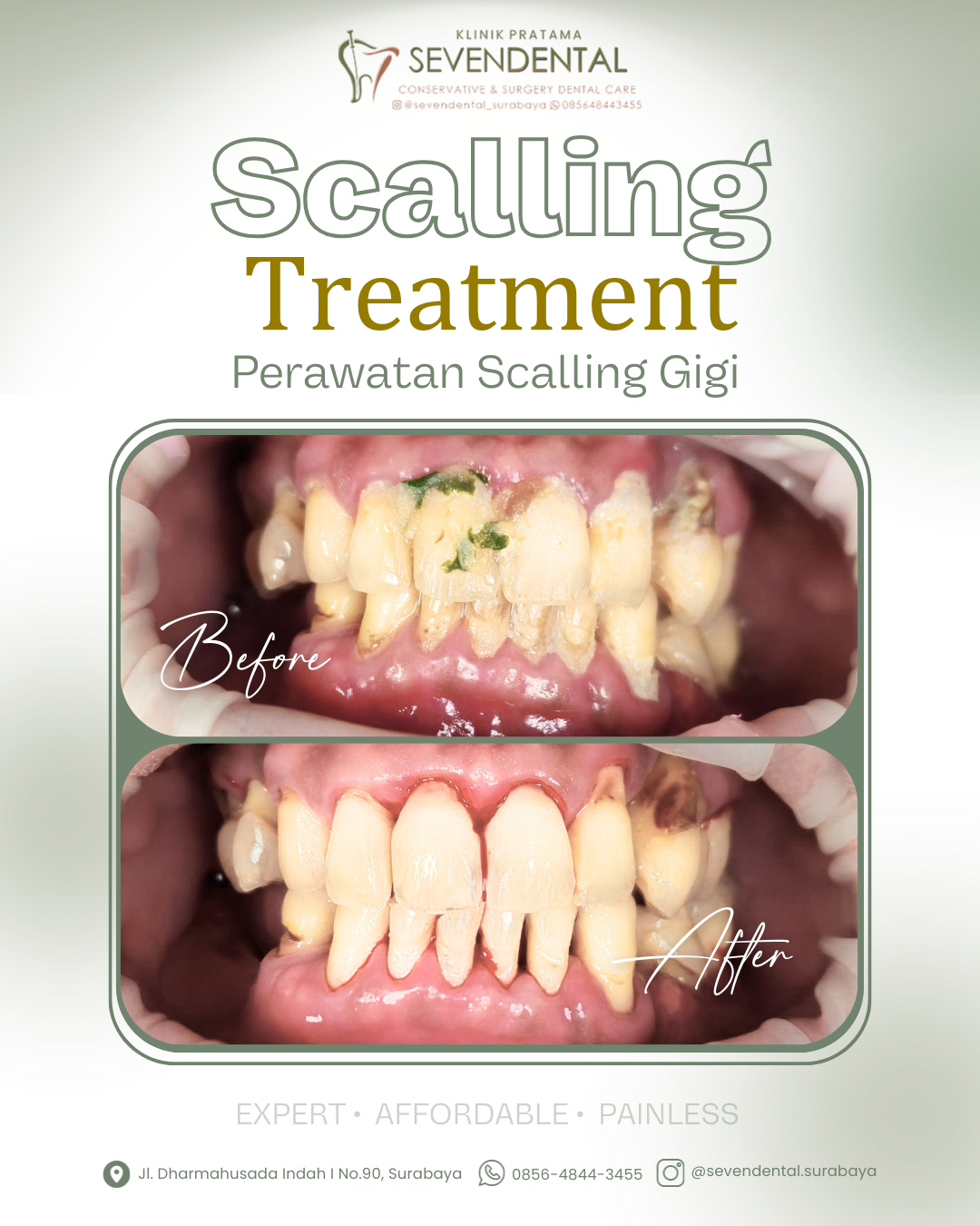 Feed BA scalling ahrens