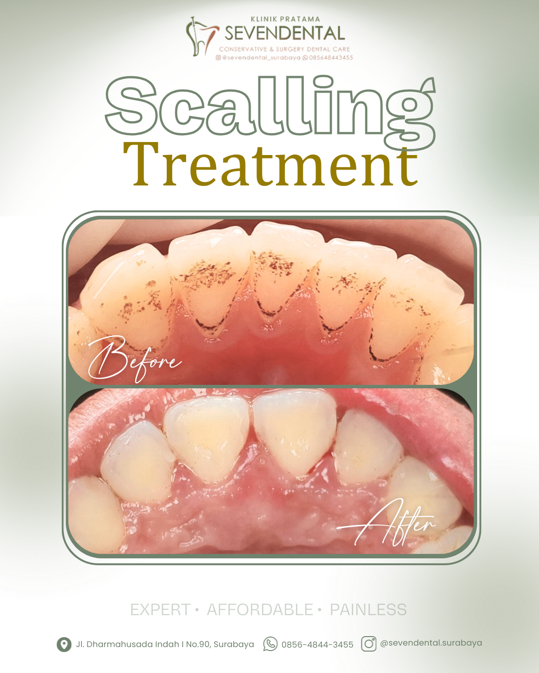 Feed Before Afrer Scalling Nn. Hilda