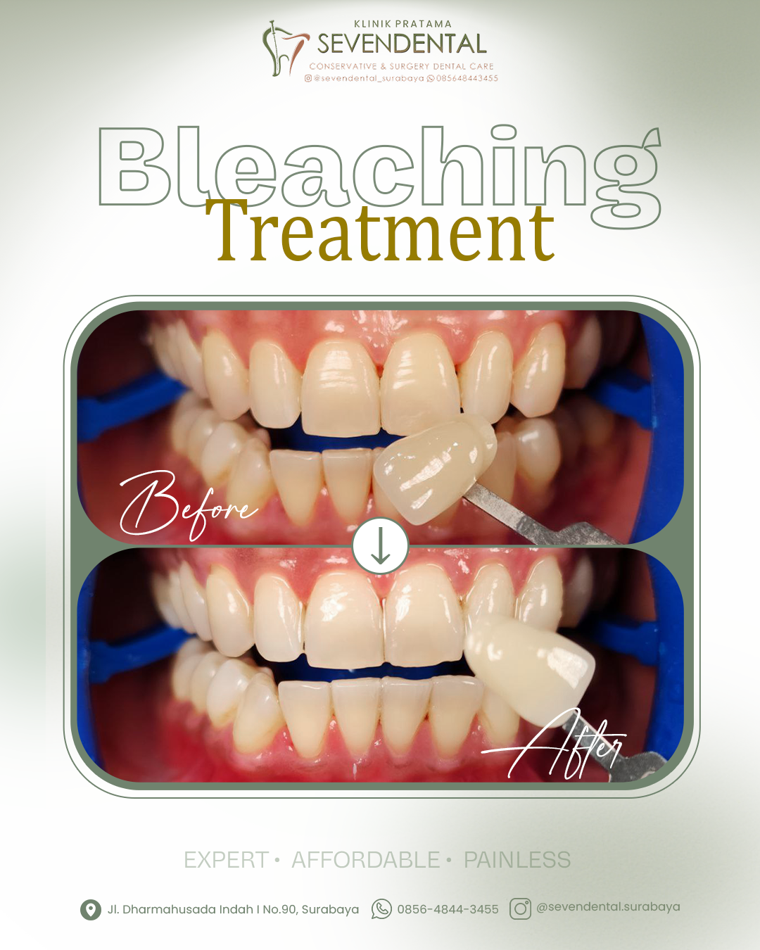 Feed Before After Bleaching soffi