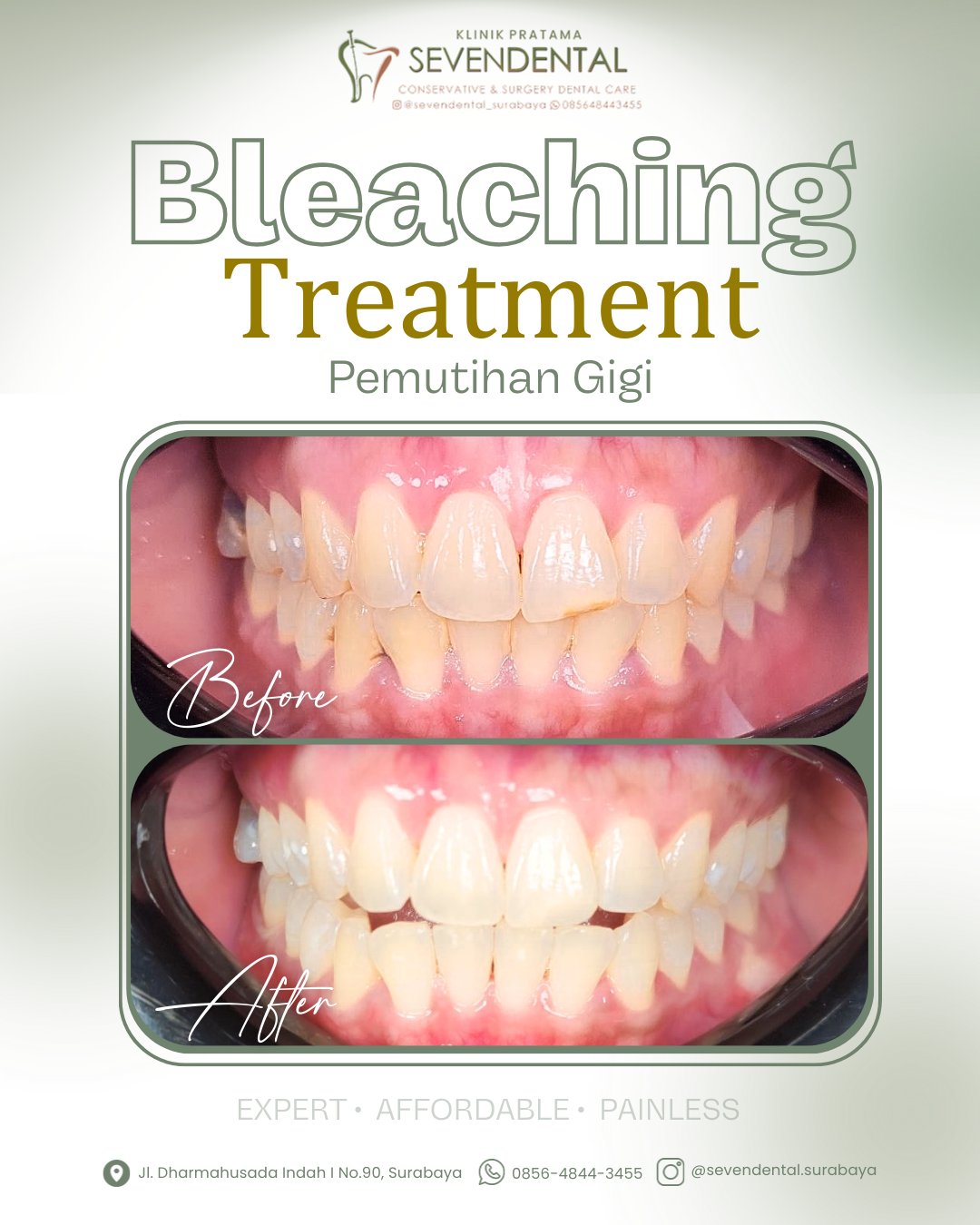 feed BA bleaching ayu